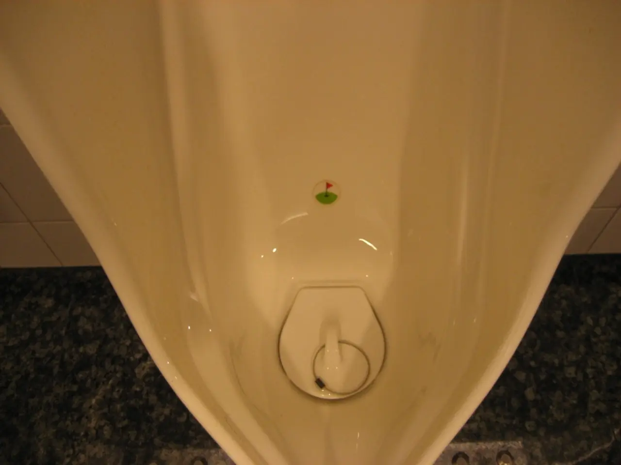 Protruding Bladder: Recognizing Symptoms, Stages, and Further Information