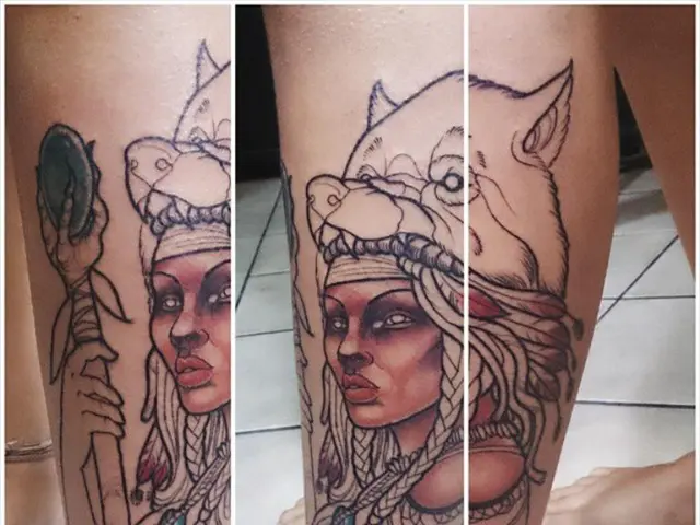 Healthcare professional erroneously removes a healthy limb, leading to a woman's tragic demise