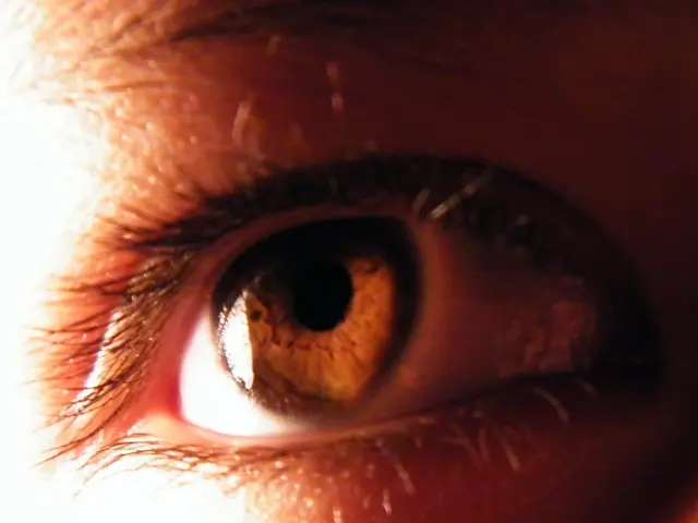 Inadequate Eyelid Closure Leads to Keratoconjunctivitis, Causing Corneal Harm