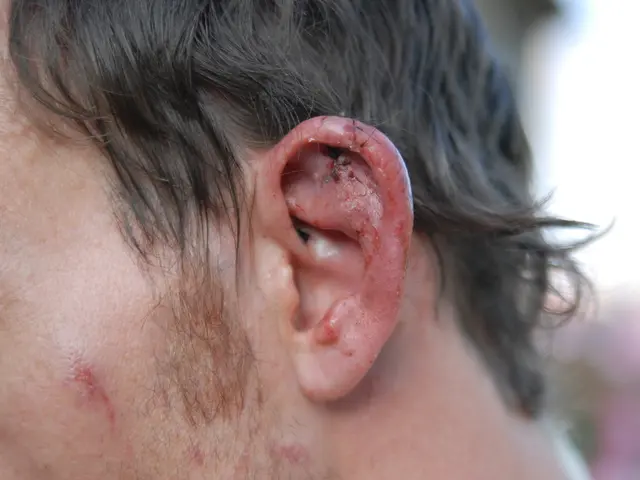 Hear, Hydrogen Peroxide Safety in Ear Explored: Risks, Concerns, and Further Details
