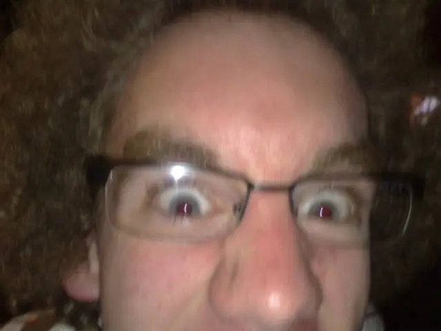 Eyes generally do not grow in size as they did at birth.