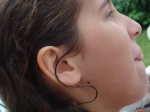 A discussion on the nature of Child Naevus, a skin condition that occurs in children.