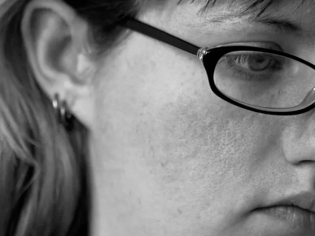 In this picture we can see face of a woman who is wearing spectacles.